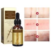 PEI MEI Collagen Scar and Acne Mark Removal Serum bottle on a marble countertop.