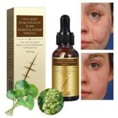 Before and after images showcasing the effectiveness of PEI MEI serum on scars.